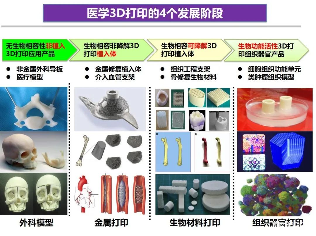 欧阳汉斌医学3d打印研究平台的建设及应用